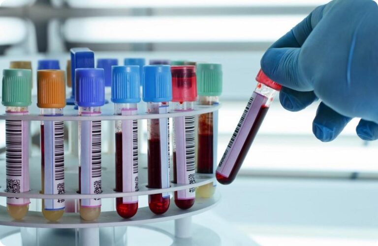 تاثیر بزرگی طحال بر ازمایش خون