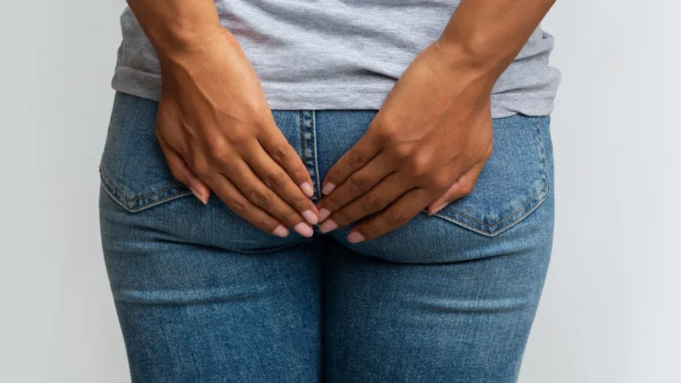 بواسیر در زنان