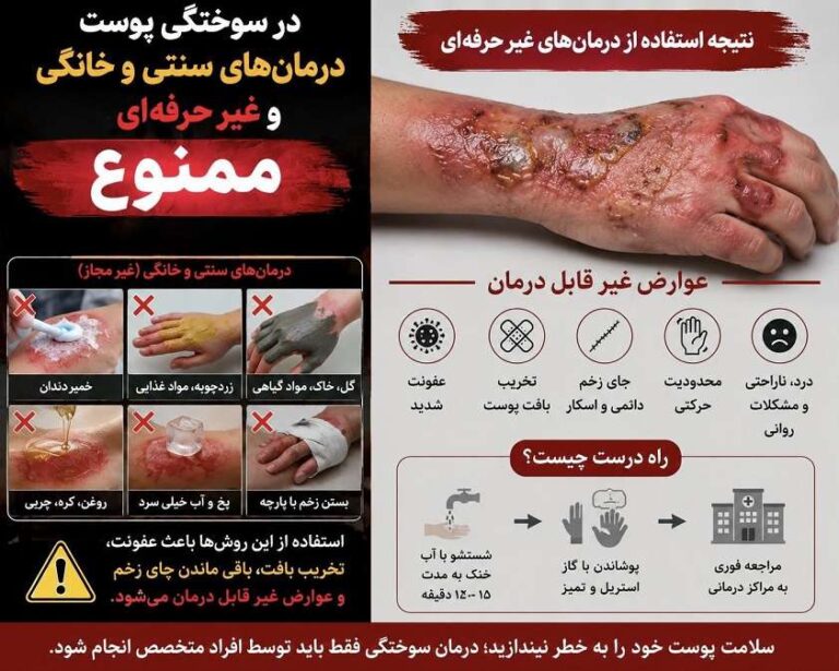 درمان سریع سوختگی
