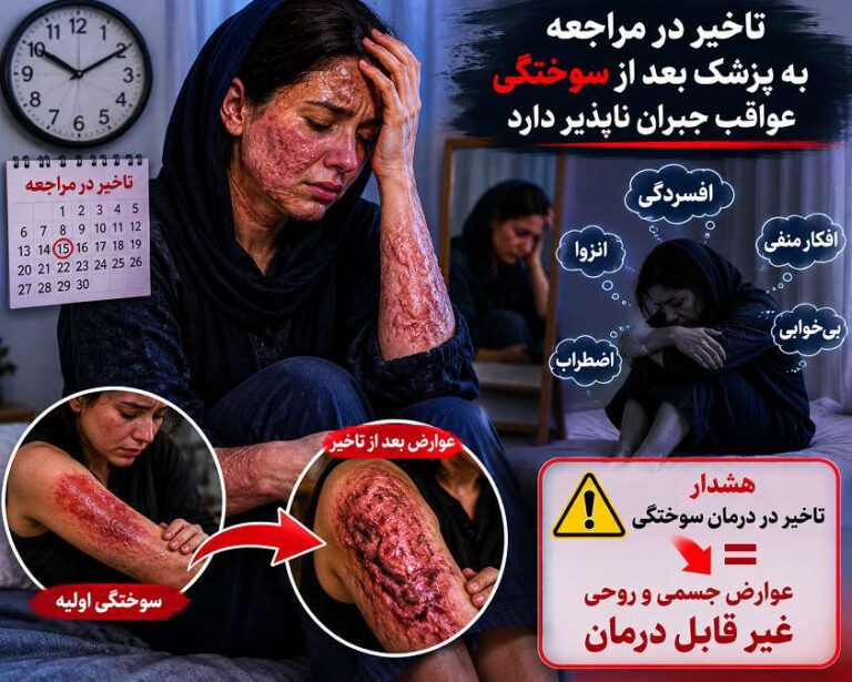 تاخیر در مراجعه به پزشک پس از سوختگی