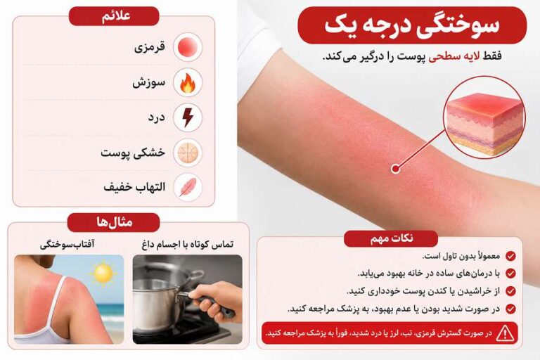 انواع سوختگی براساس شدت