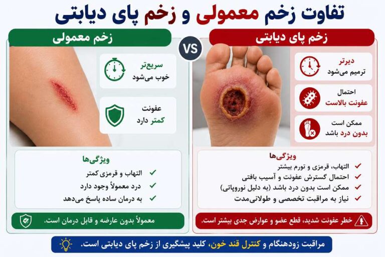 درمان زخم پای دیابتی در سالمندان