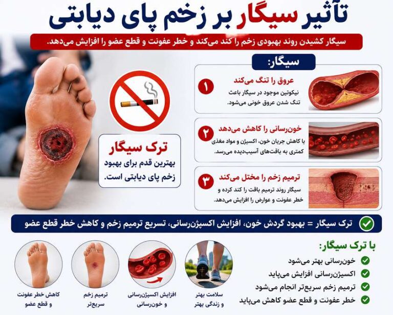 تاثیر سیگار بر زخم پای دیابتی