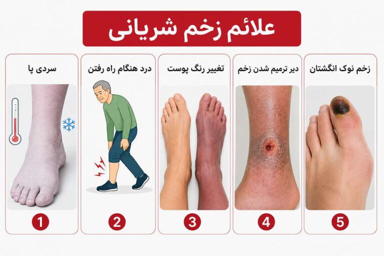 علائم زخم شریانی