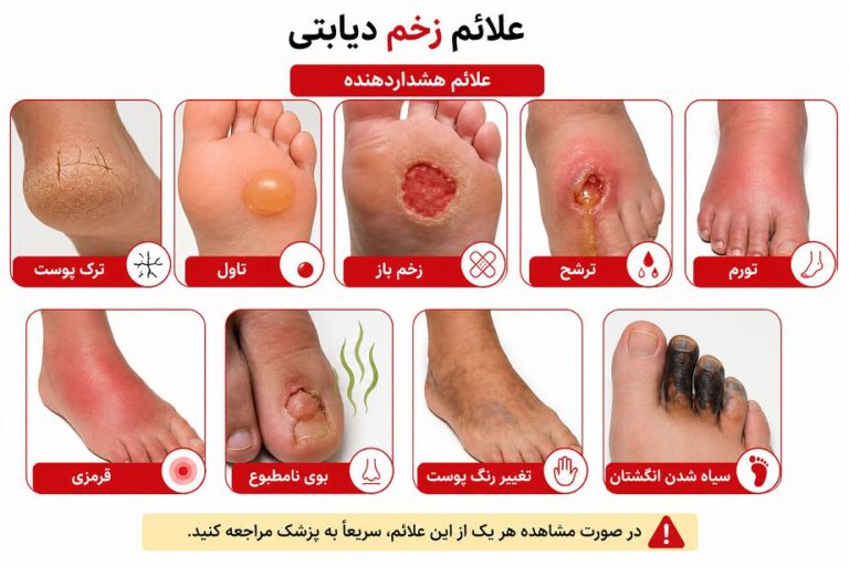 علائم زخم دیابتی