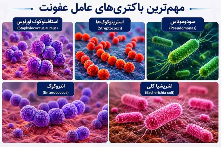 بامتری عامل ایجاد عفونت