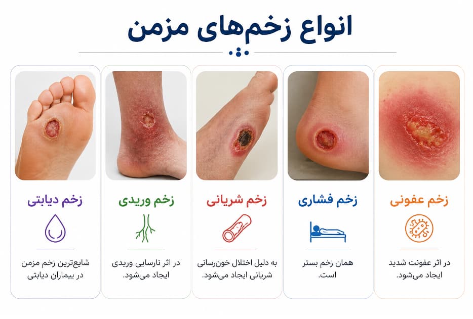 انواع زخم‌های مزمن شامل زخم دیابتی، وریدی، شریانی و فشاری