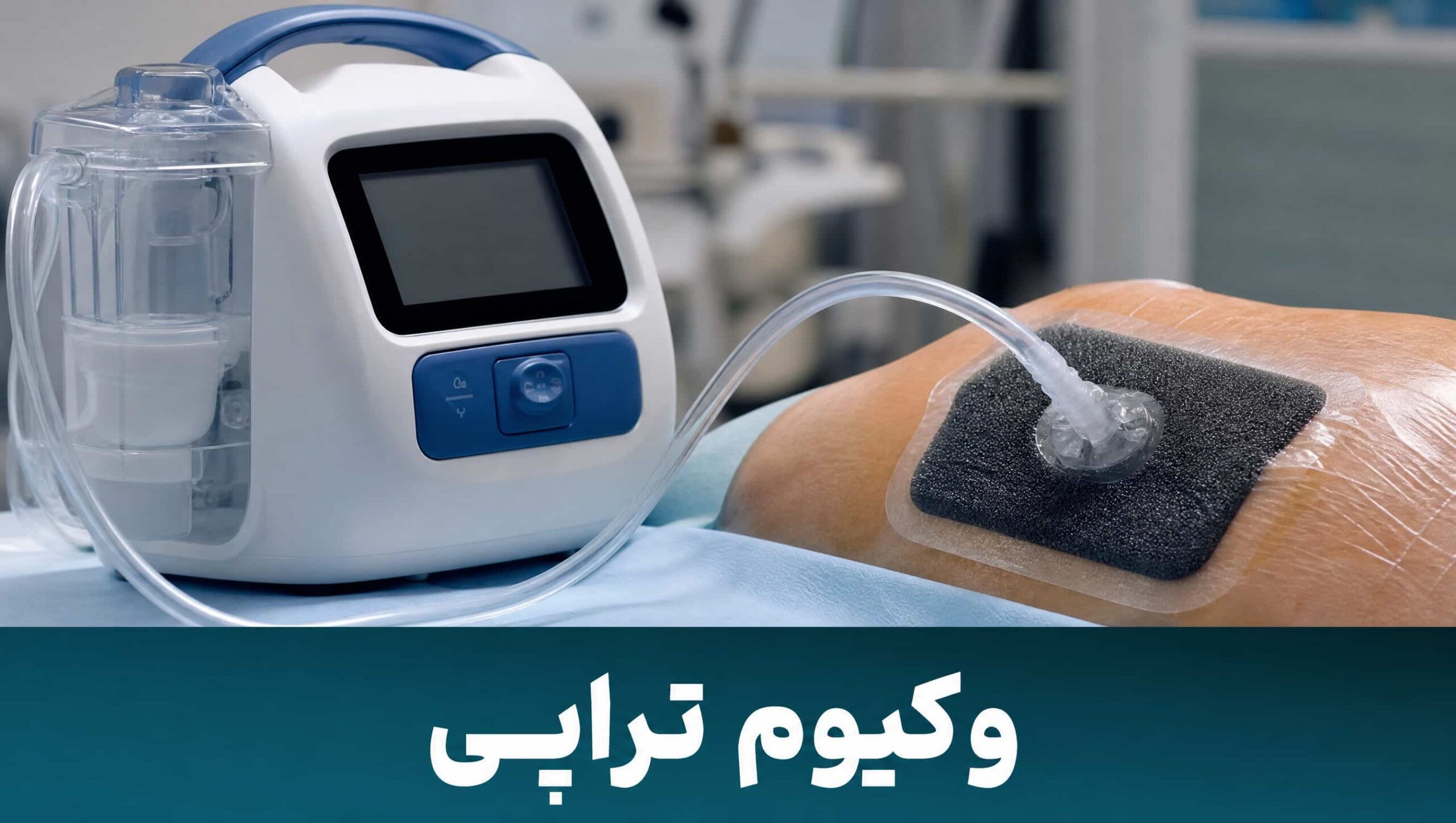 دستگاه وکیوم تراپی فشار منفی برای درمان زخم پیچیده دیابتی