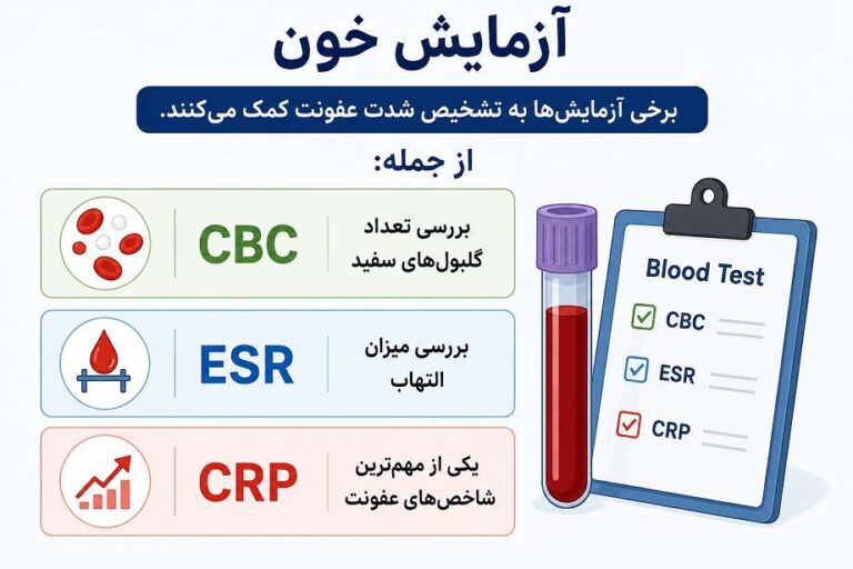 انجام آزمایش خون