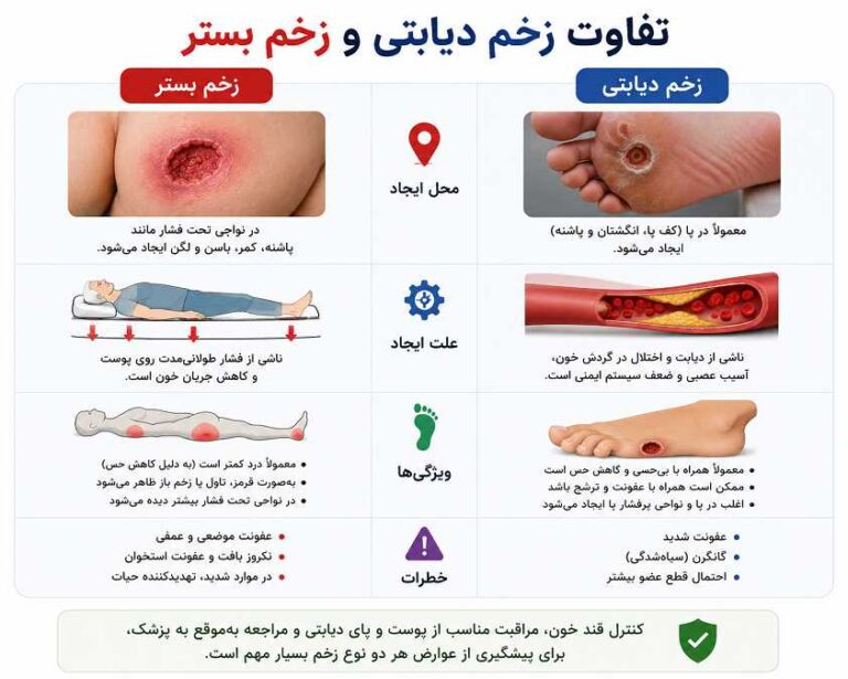تفاوت زخم دیابتی و زخم بستر